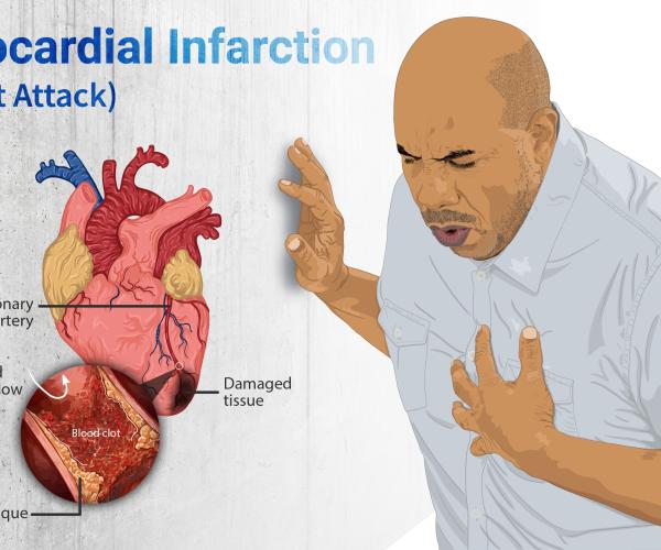 Heart attack wikimedia image